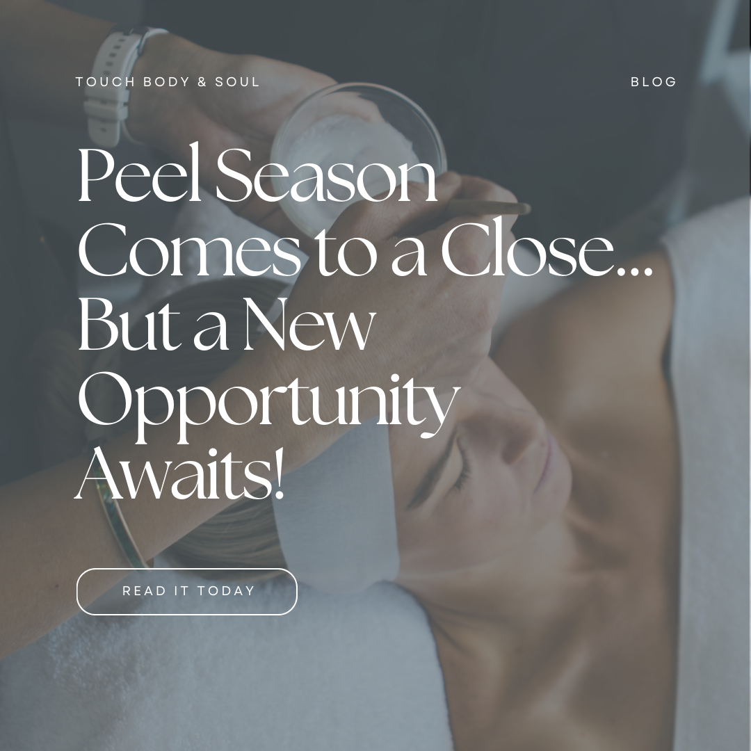 Peel Season Comes to a Close... But a New Opportunity Awaits!