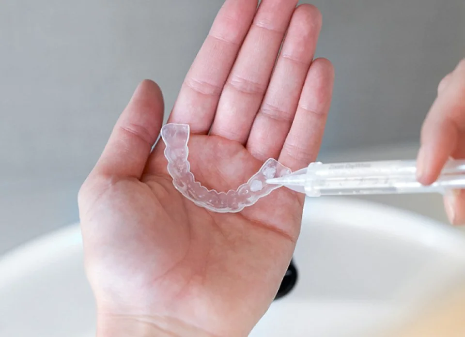 Custom-made take-home whitening trays with clinical-strength whitening gel for professional teeth whitening in Hampton.