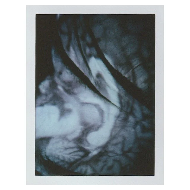 Here is a T1 MRI sagittal view of a 48 year old Caucasian woman. 

Thanks to the Allen Institute for their help and support ~ Original image courtesy of the Allen Institute.
.
.
.
.
.
.
.

#maternalworld #neuroscience #maternalbrainchanges #analogpho