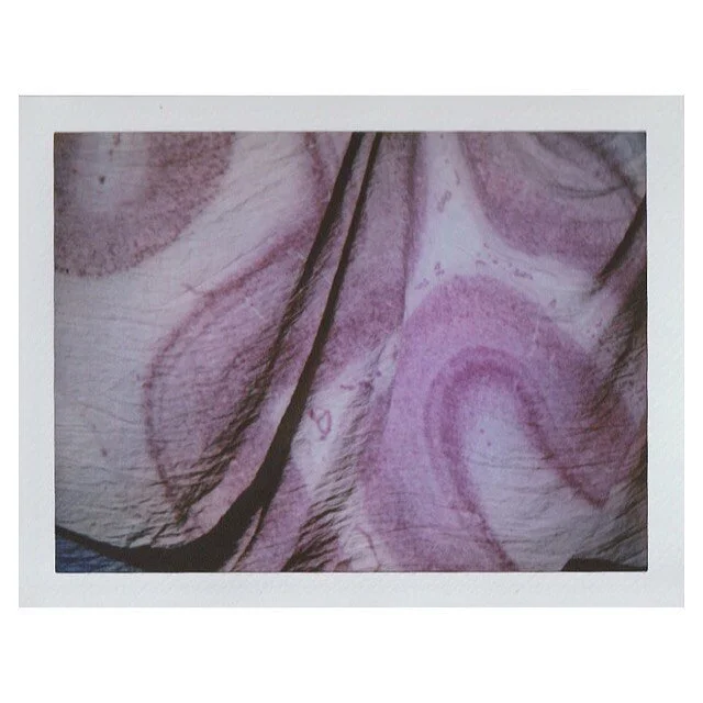 The beautiful visual cortex of a 31 year old woman, on instant film. 

Thanks to the Allen Institute for their help and support. Original image courtesy of the Allen Institute. .
.
.
.
.
.
.

#maternalworld #neuroscience #maternalbrainchanges #analog