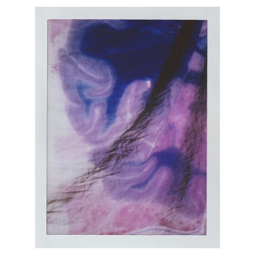 NISSL stain coronal view of a sliced female brain, on instant film. 

Thanks to the Allen Institute for their support ~ Original image courtesy of the Allen Institute.
.
.
.
.
.
.
.

#maternalworld #neuroscience #maternalbrainchanges #analogphotograp