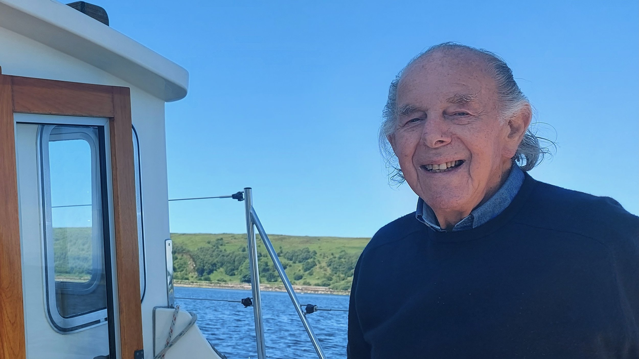 The Hips of an 84-year old