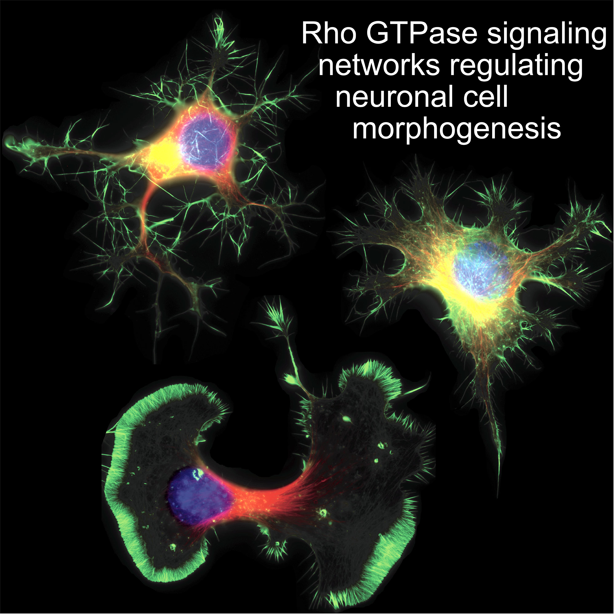 neuronal cell morphogenesis 2000x2000 final.png