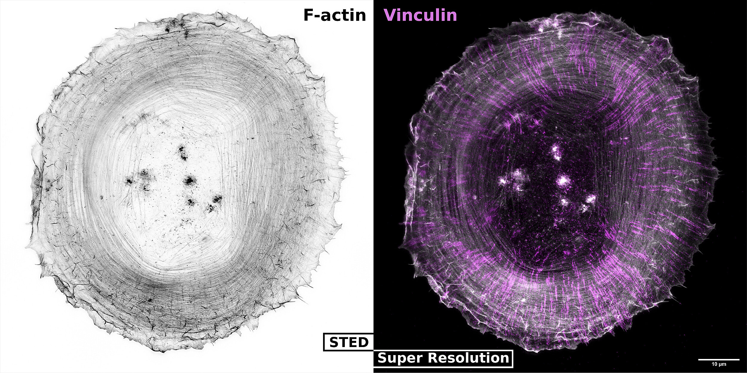 STED image of F-actin and Vinculin in REF-52 fibroblasts