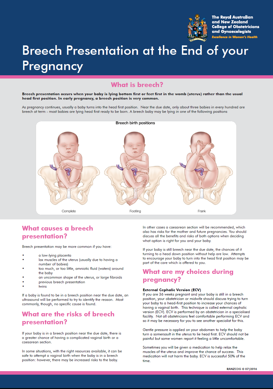 Breech-Presentation-at-the-End-of-your-Pregnancy.png