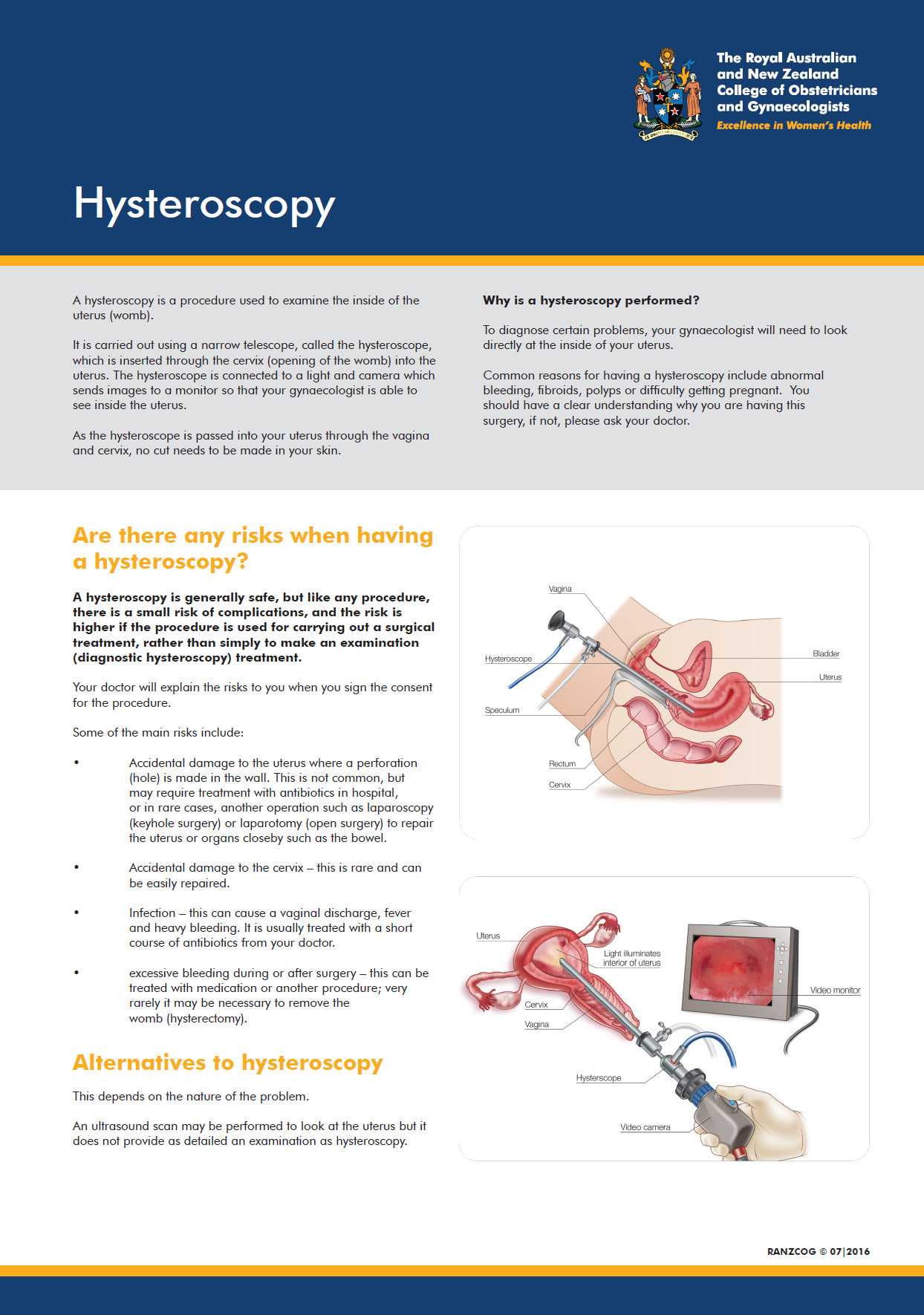 Hysteroscopy.png