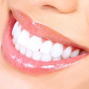 teeth-white-square-300x300.jpg
