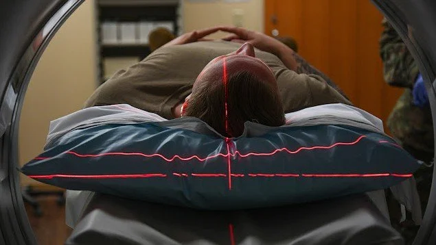 Revolutionizing Shoulder Instability Research with 3D MRI Imaging and AI