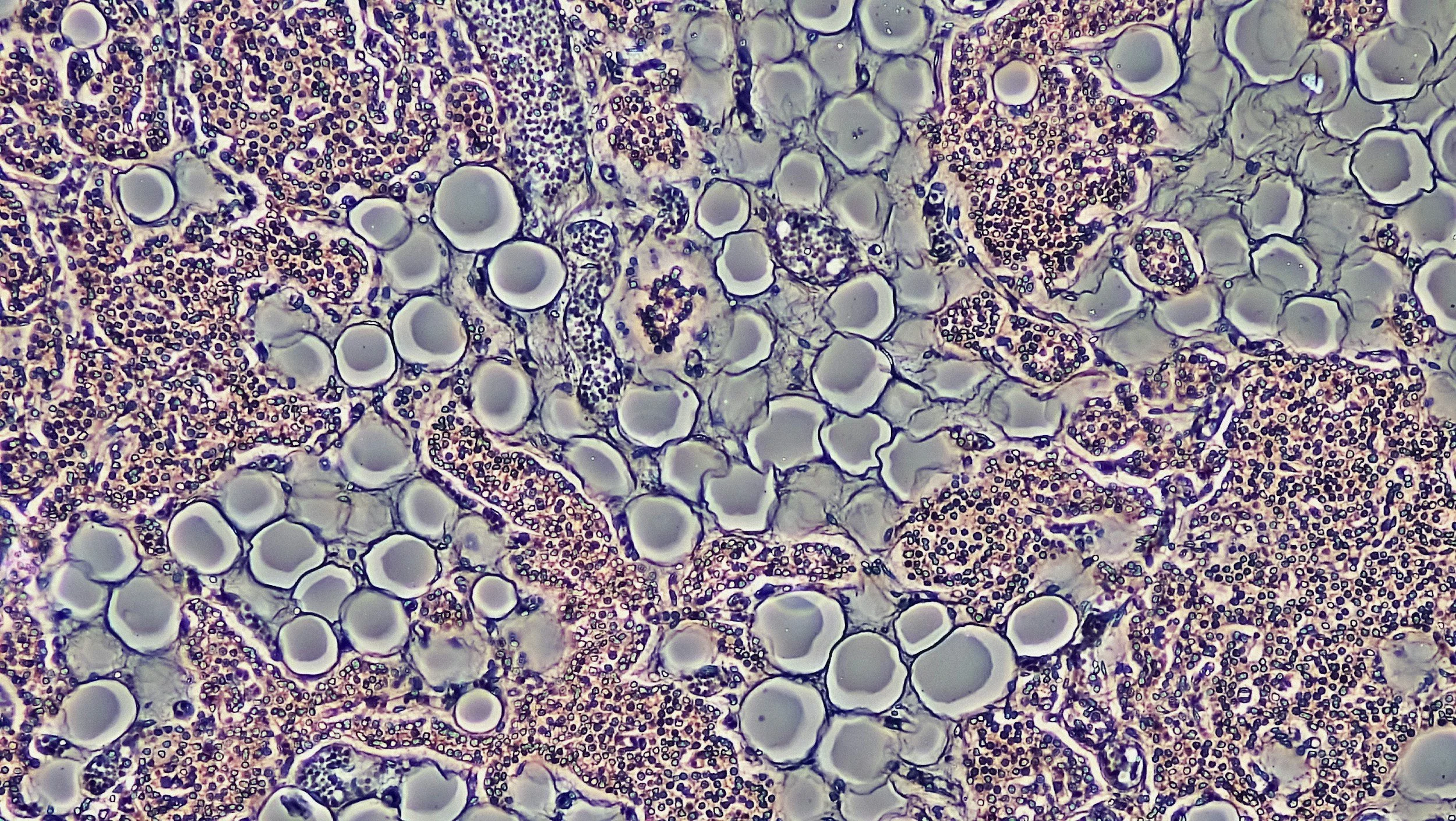 Stem cells