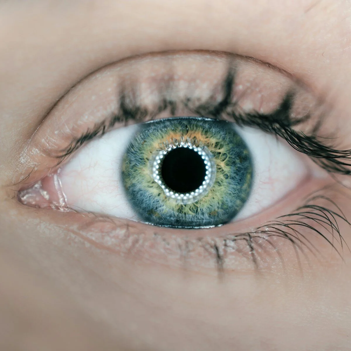 S3.14 The eyes have it: From genetics to gene therapy