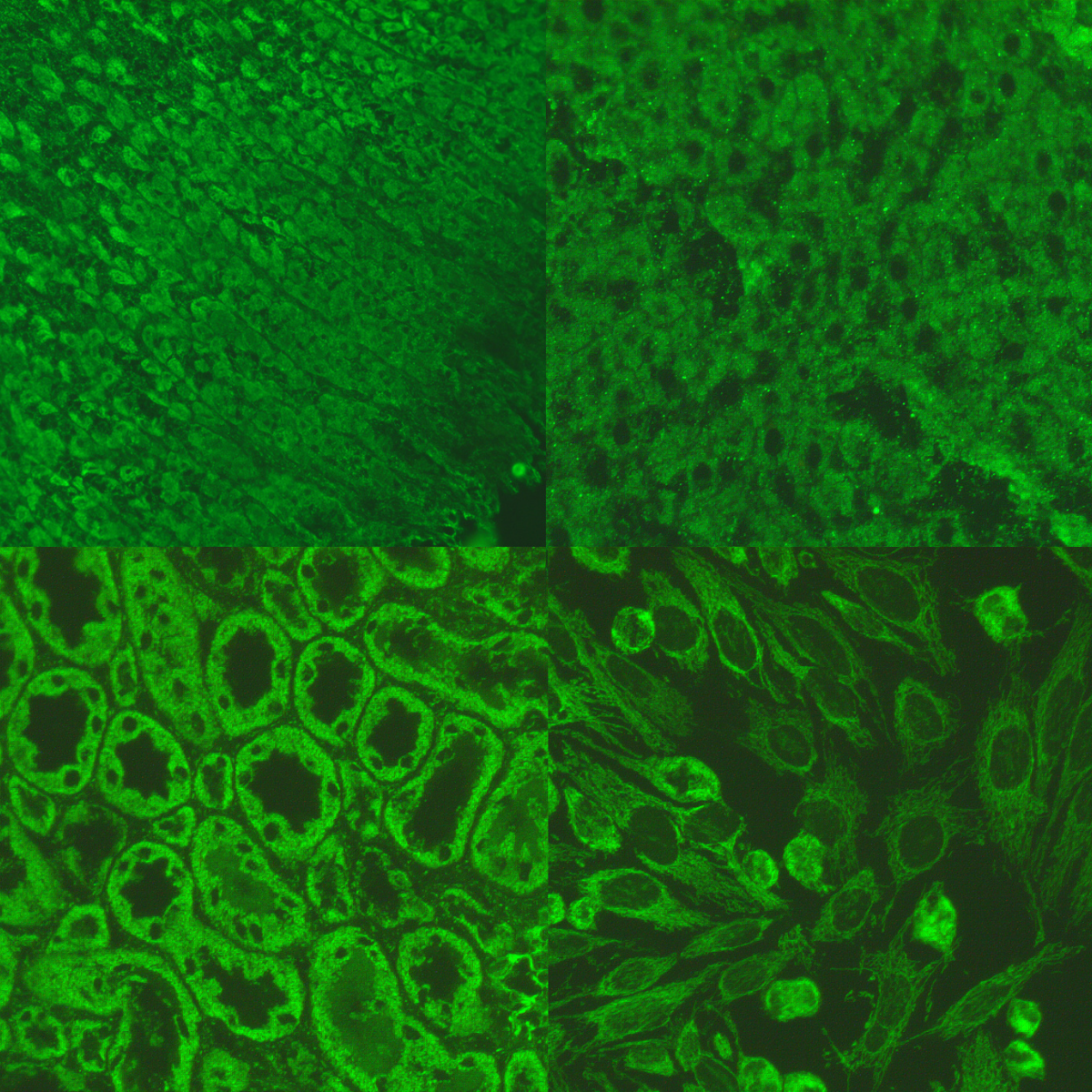 S4.11 From genes to drugs to bugs: How genetic engineering is used to make medicines