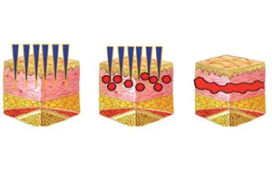 Vivace - Collagen.jpg