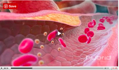 Awesome Medical Visualizations