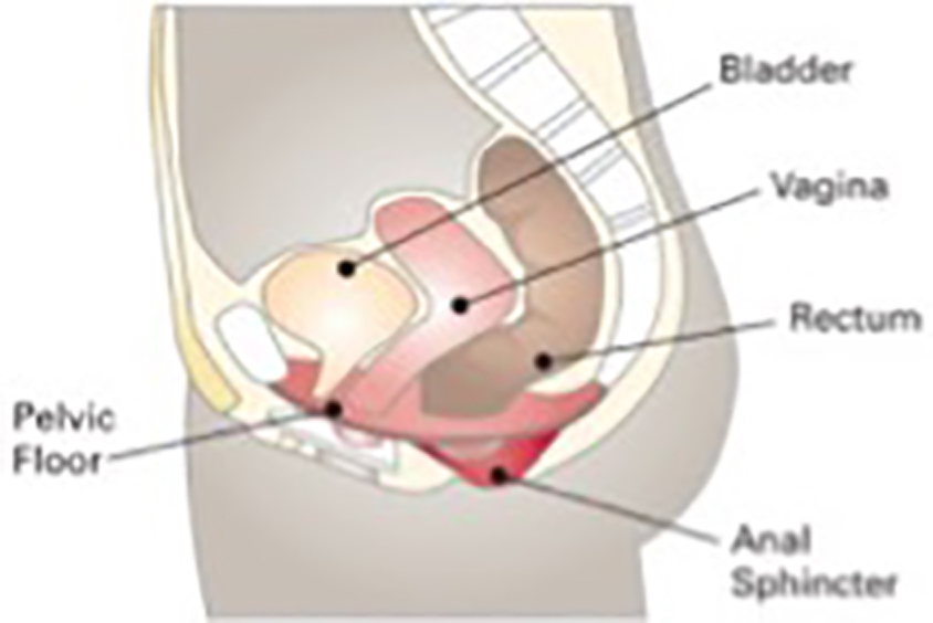 Prolapse.jpg
