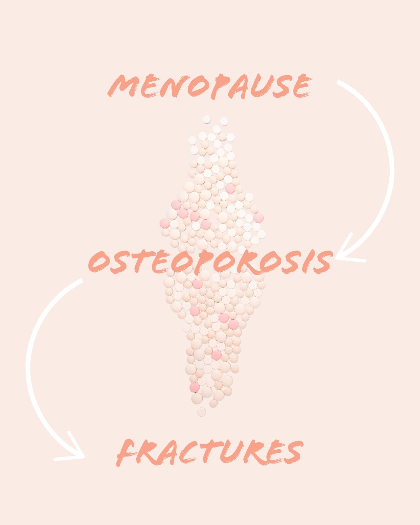 🦴 Bone Health After 40

Women can lose up to 20% of their bone density in the years following menopause, increasing their risk of fractures.

Join us on July 3rd for our next Menopause Matters education session, where we&rsquo;ll explore the impact 