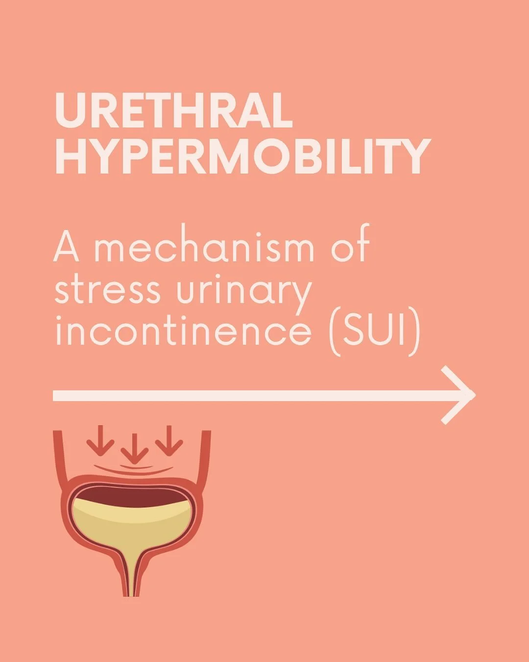 💧 Understanding Urethral Hypermobility

When the tissues that support your urethra become stretched or weakened, the urethra can move more than it should when you cough, sneeze, laugh or lift.

This is called urethral hypermobility and it is a commo
