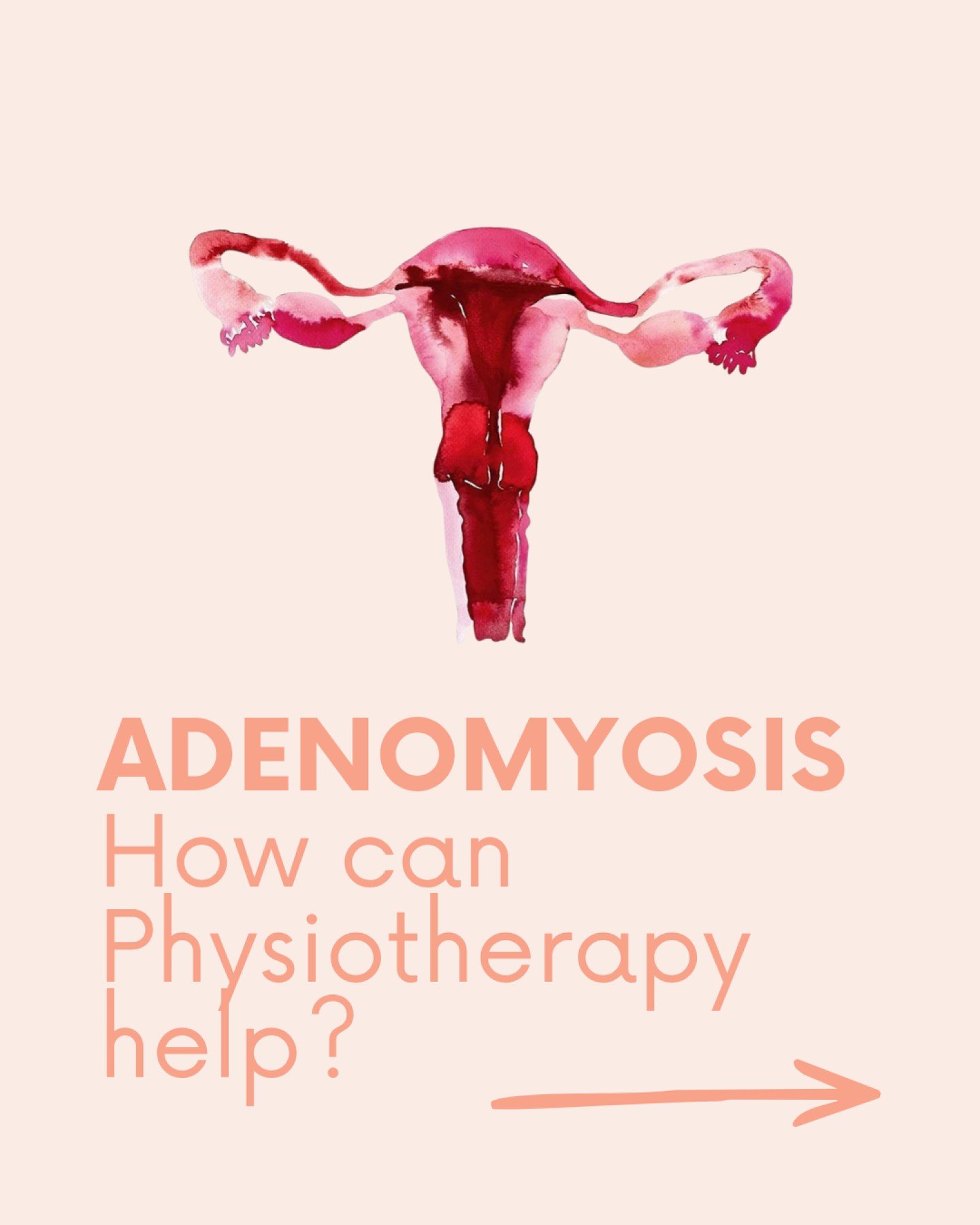 How can physio help adenomyosis? 💛

Adenomyosis is complex, and management often requires a multidisciplinary approach. But physiotherapy can play a really important role in supporting pelvic pain and day-to-day function.

In clinic, this might invo