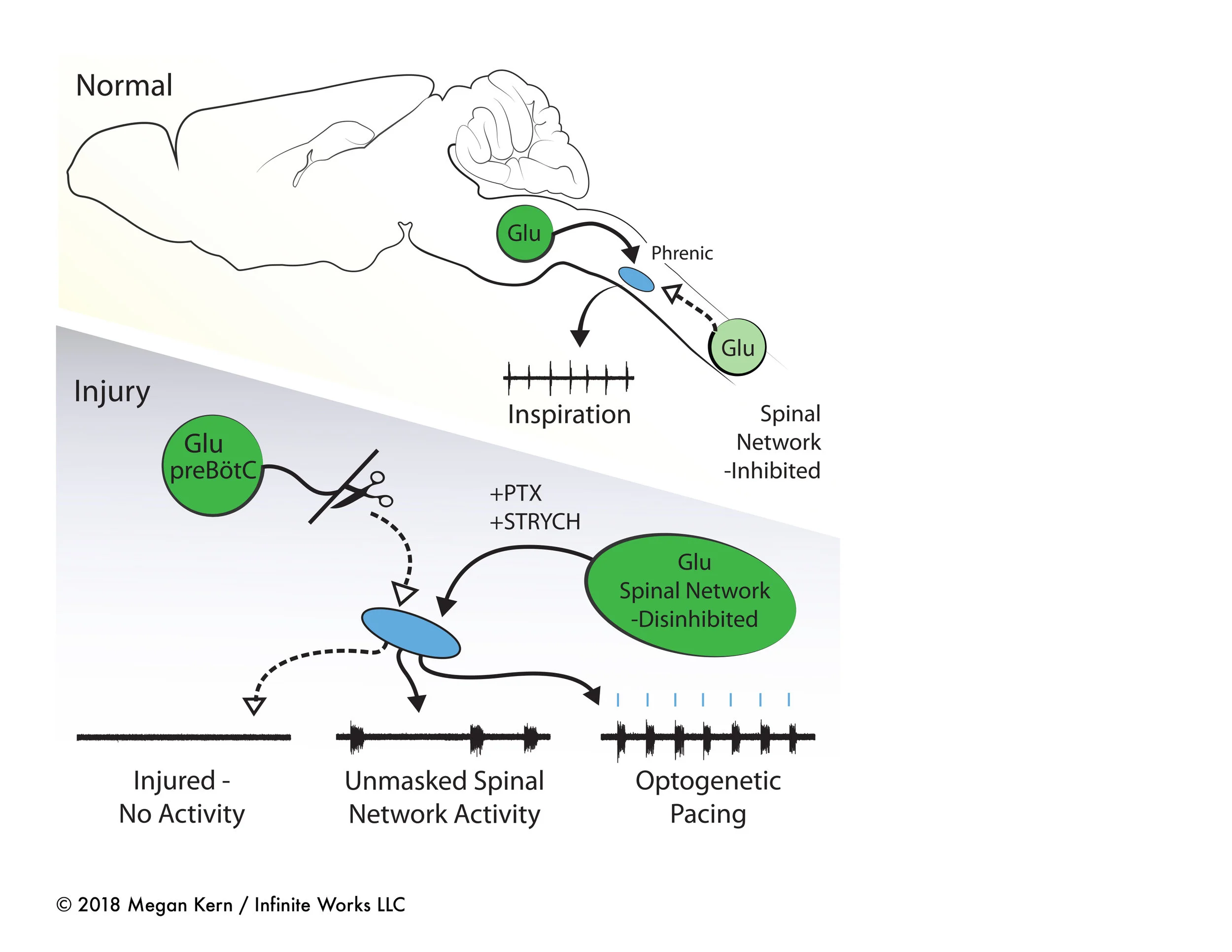 Spinal Cord Injury Illustration