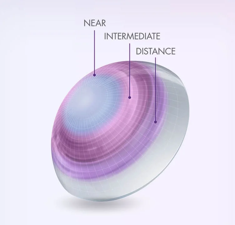 Presbyopia and Multifocal Contact Lenses