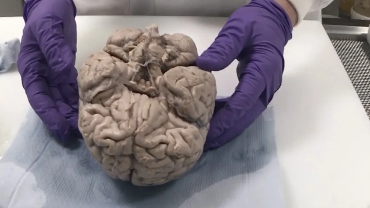 brain-bank-blog.jpg