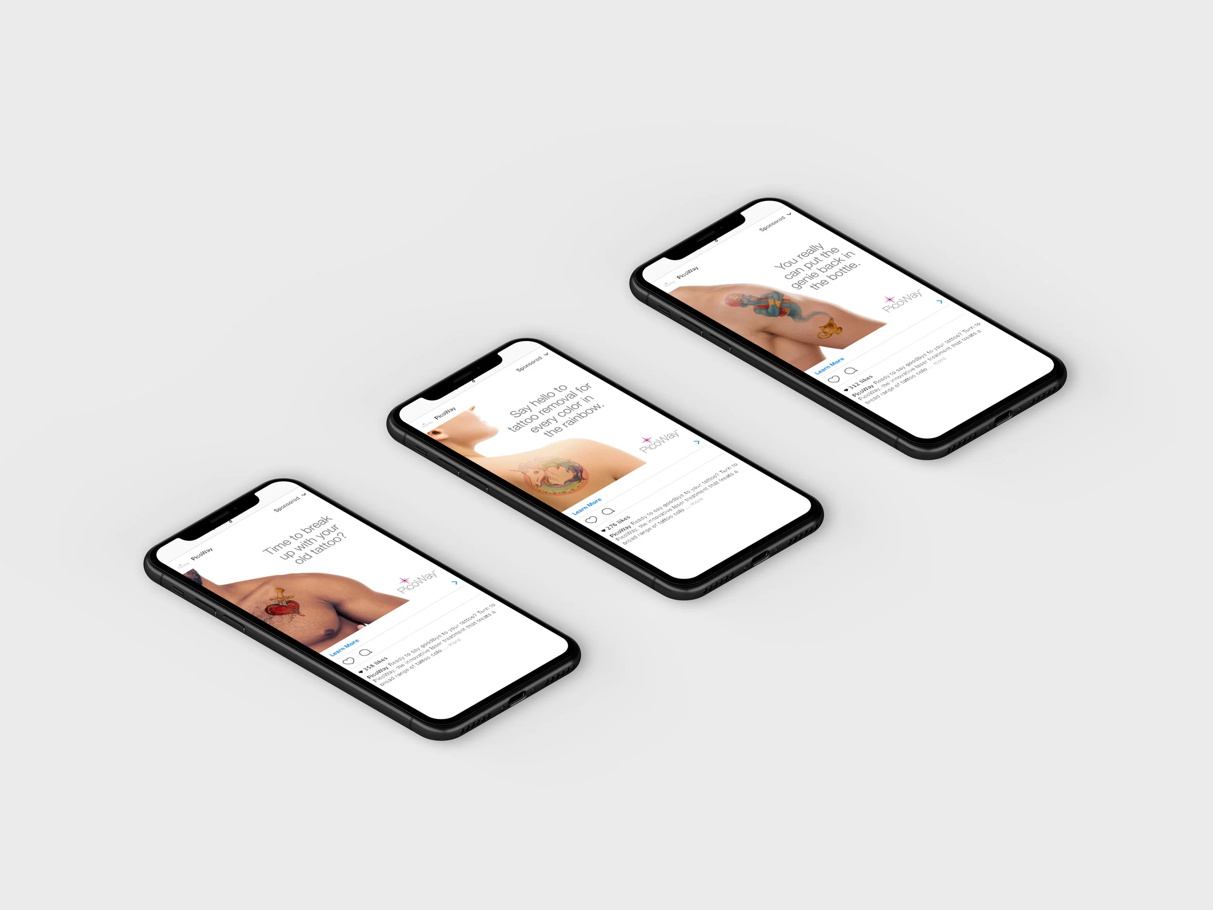 PicoWay Tattoo Removal