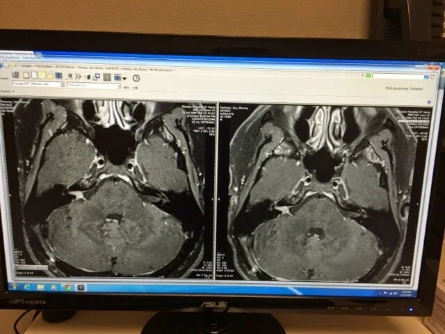 MRI Results!!!