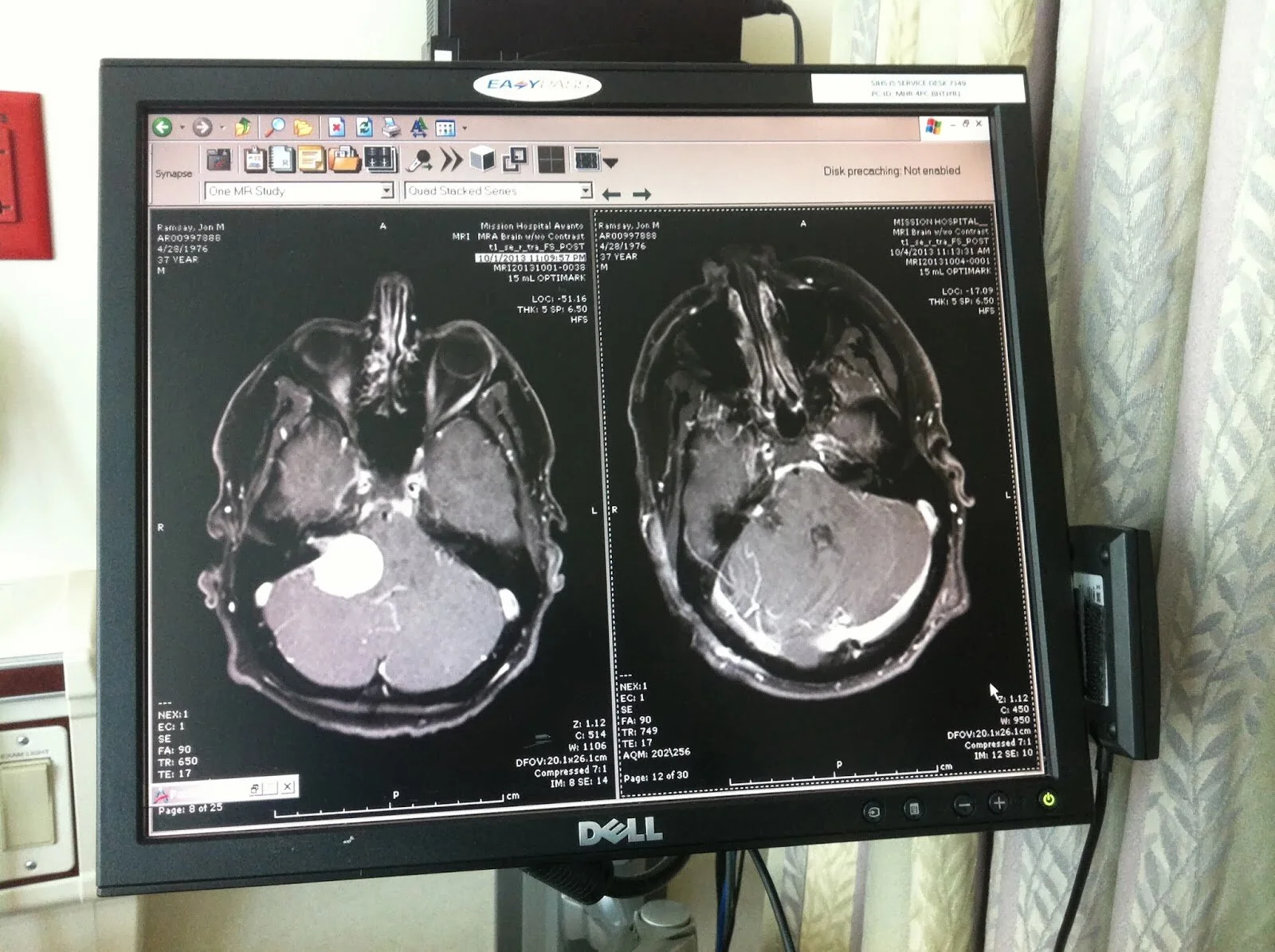 Now You See It.... Now You DON'T!  