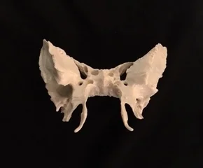 All About the Sphenoid