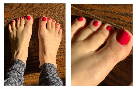 Actual photos of my toes today.