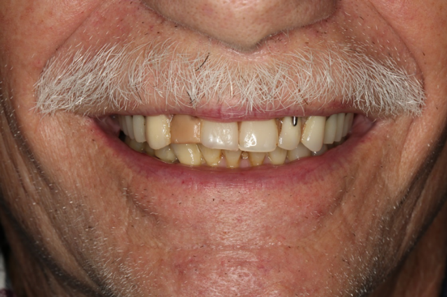 Norberts Teeth.png