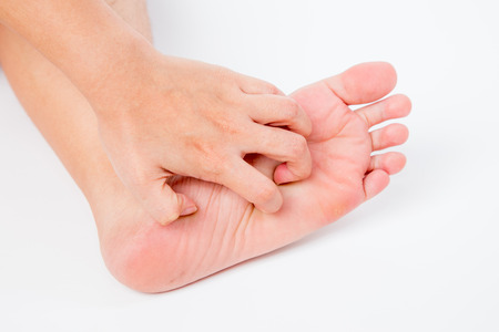Ask the doctor: My toes itch constantly and I don't know why |  Independent.ie