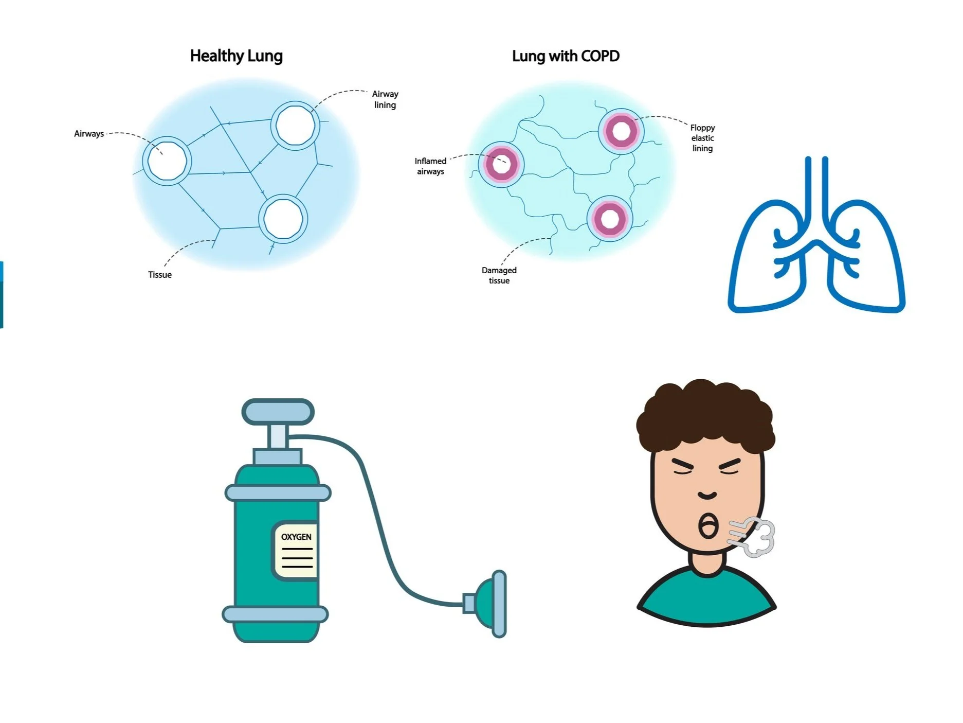 New Spirometry Clinics at the Driffield ARI HUB