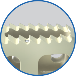 PLIFT_Gen2_Teeth01.jpg