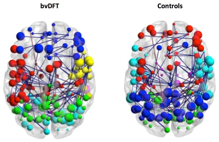 brain+DFT+networks.jpg