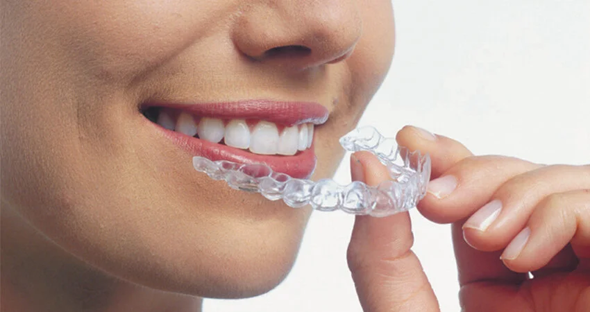 does invisalign take longer