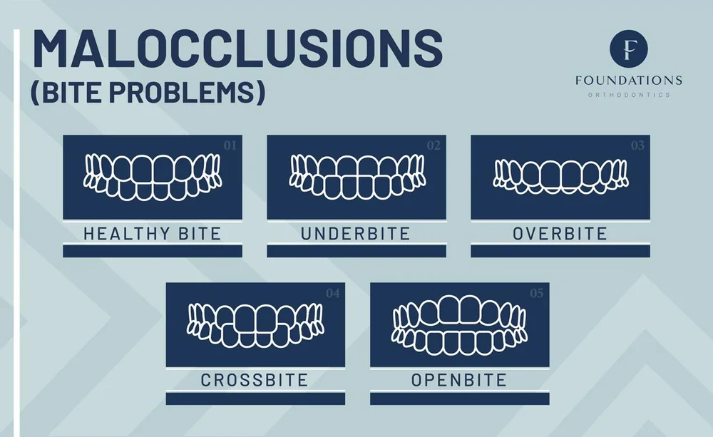 Anatomy of a Healthy Bite Foundations Orthodontics Orthodontist and