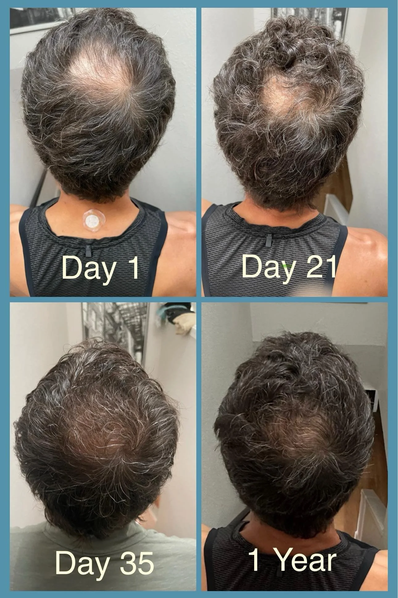 Hair.jpg