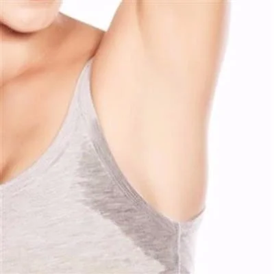 Hyperhidrosis