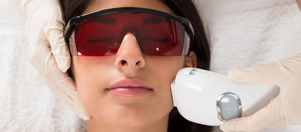 Laser Treatments