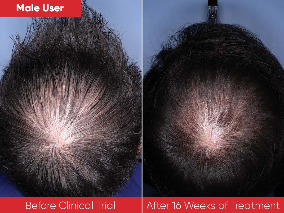 REVIAN_Red_B&A_Male_1200x898px_1