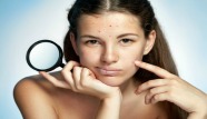 how-to-get-rid-of-blackheads.jpg
