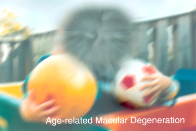© Photo by: National Eye Institute, National Institutes of Health