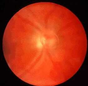 Eye7.jpg
