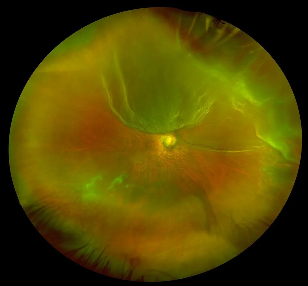 Eye8.jpg