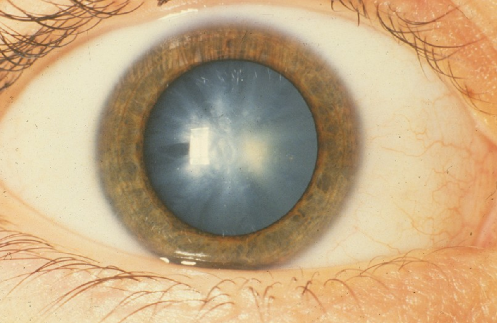 Eye5.png