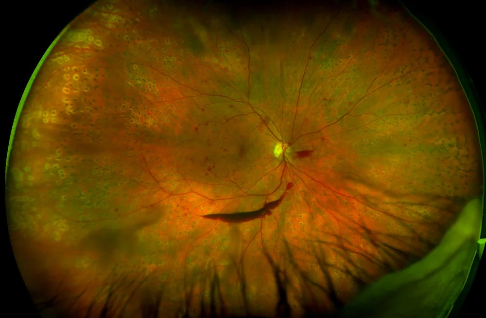 Eye10.jpg