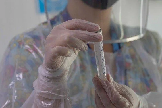 Casos siguen a la baja 