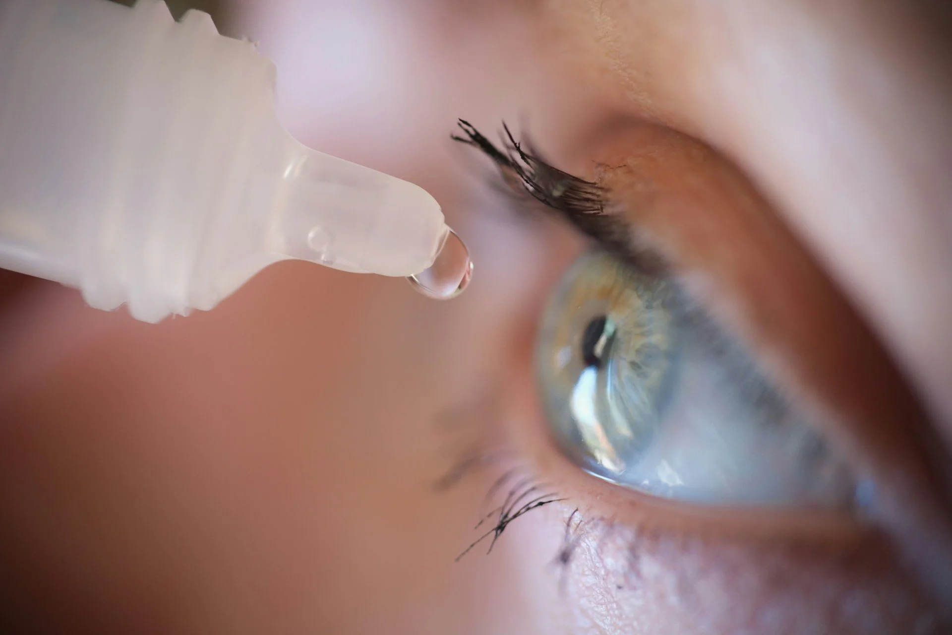 Allergy vs. Dry Eye in St. Cloud, FL: How to Tell the Difference