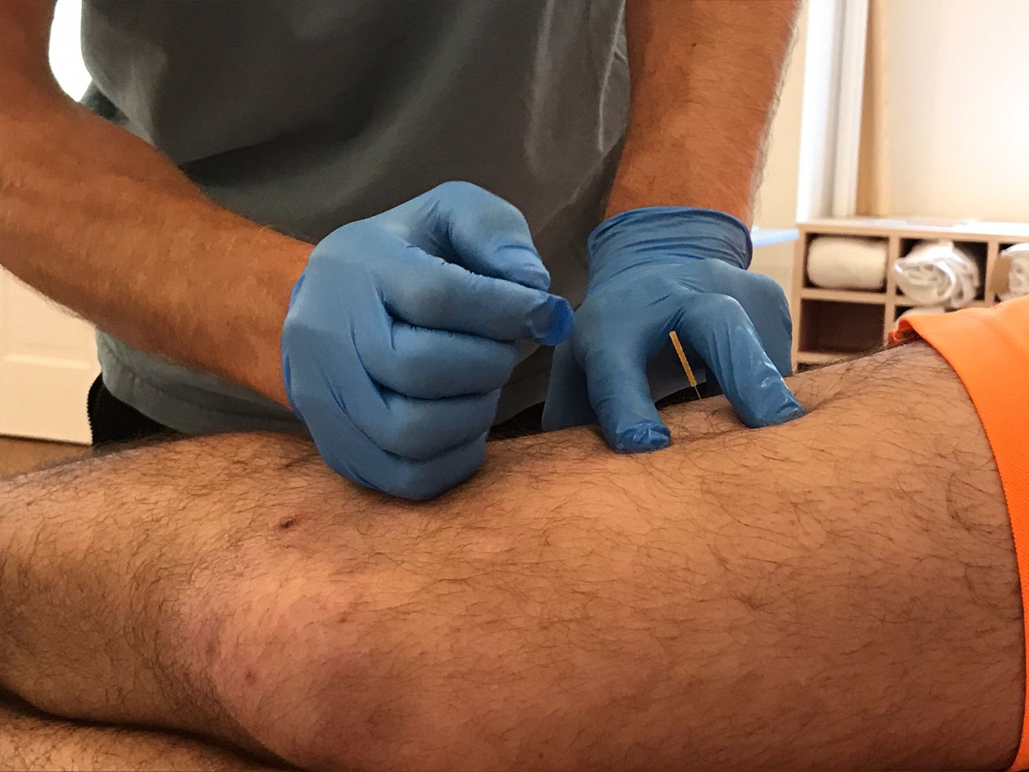 Simon Aeschbacher Dry Needling.JPG