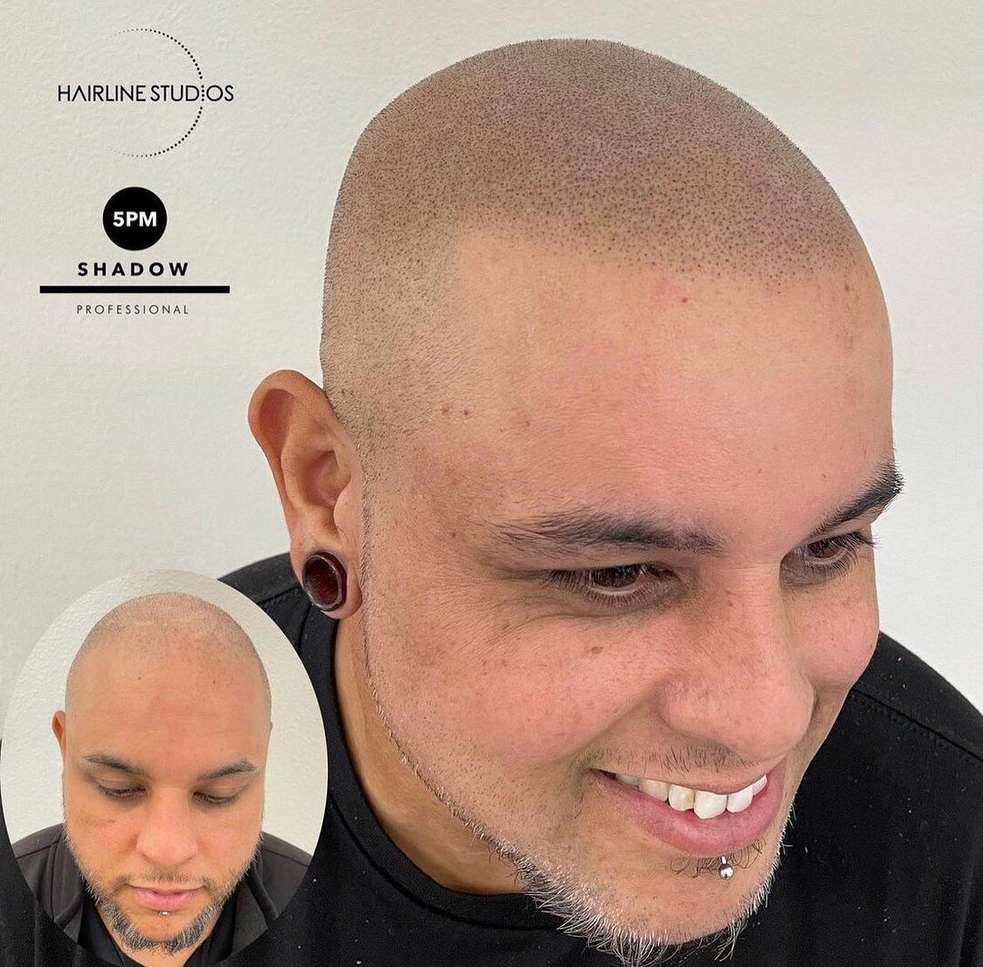 The time is finally here! I&rsquo;m heading to Orlando for a week to complete an intensive scalp micro-pigmentation course with one of the greatest 
✨Fernando at @hairline_studios ✨
Check out some of his work!

So excited! We&rsquo;ve been planning t